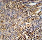 Polyclonal Rabbit anti-Human TANK Antibody (aa88-114, IHC, WB)