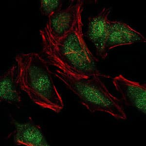 IHC-plus™ Monoclonal Mouse anti-Human NEDD8 Antibody (clone 5B8, IHC, IF, WB)