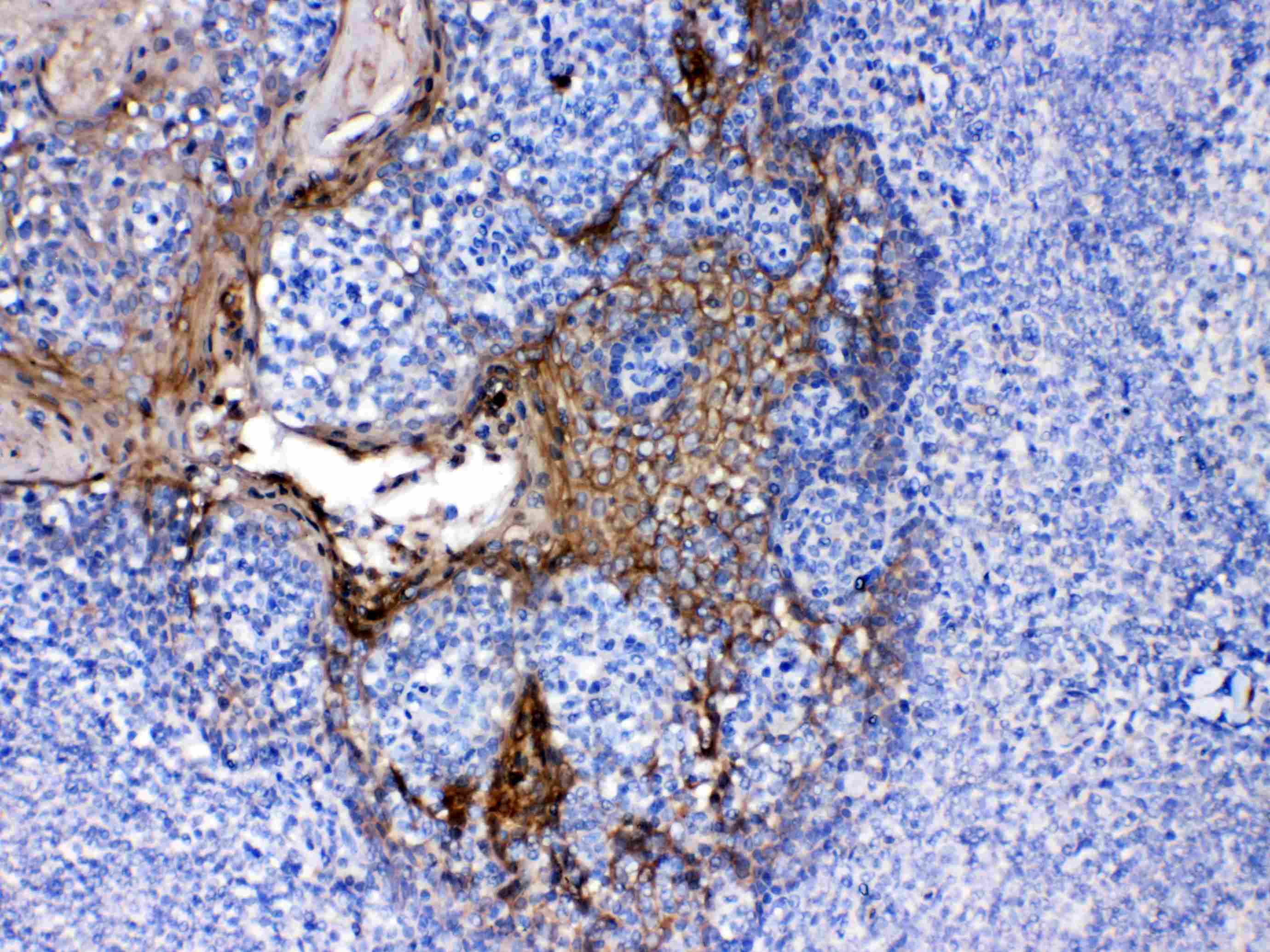 PPL / Periplakin Antibody