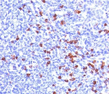 Monoclonal Mouse Anti-Human Kappa Light Chain Secondary Antibody (clone KLC709, Ready-to-Use, IHC)