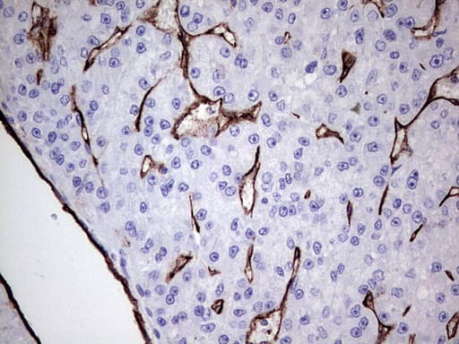 PECAM-1 / CD31 Antibody (clone UMAB164)