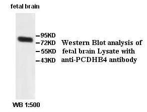 Polyclonal Rabbit anti-Human PCDHB4 / Protocadherin Beta 4 Antibody (aa148-437, IHC, WB)