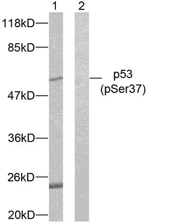 Polyclonal Rabbit anti-Human TP53 / p53 Antibody (phospho-Ser37, WB)