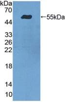 ITGA9 / Integrin Alpha 9 Antibody (aa741-965, Cy3)