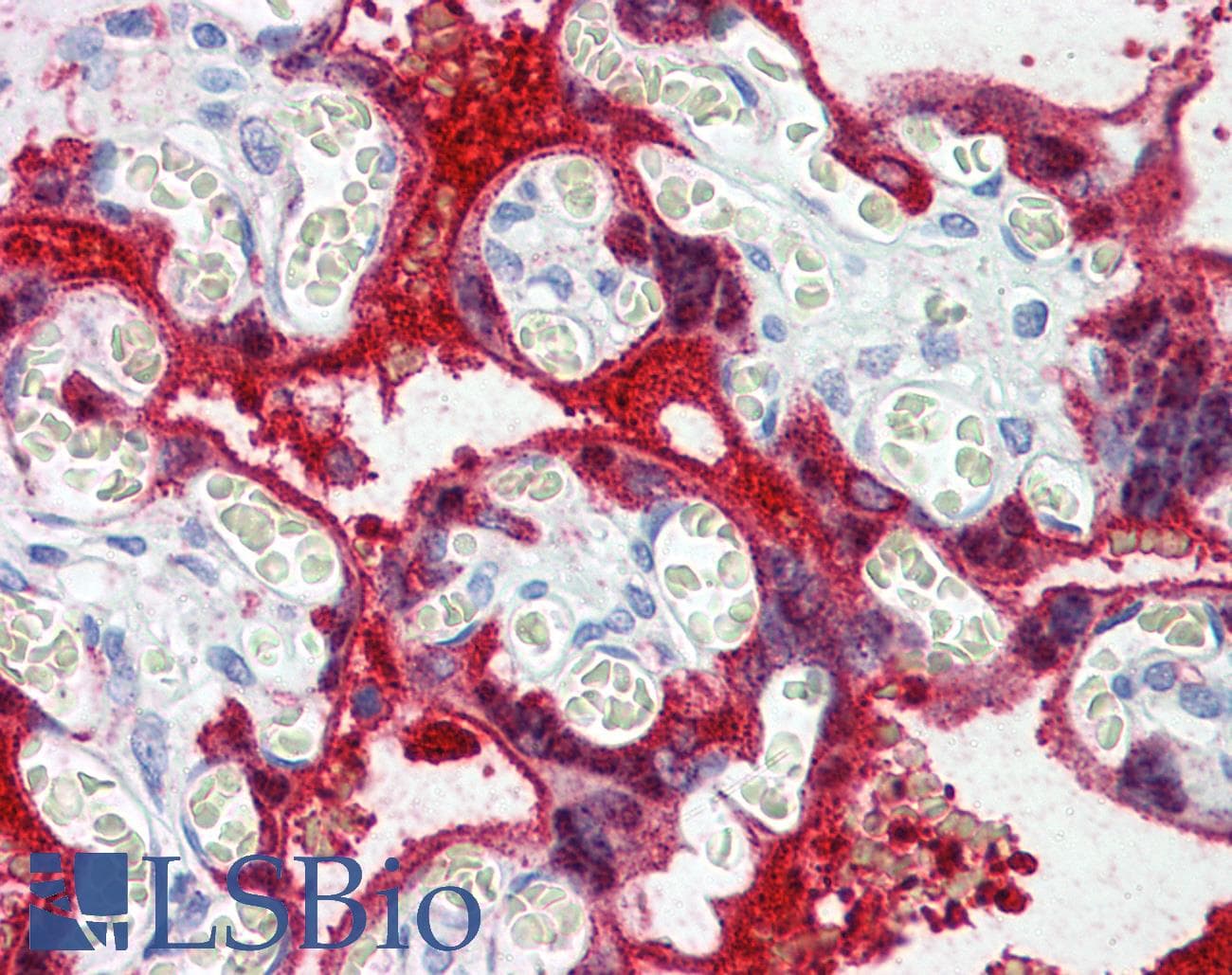 Polyclonal Rabbit anti-Human TGM2 / Transglutaminase 2 Antibody (aa431-480, IHC, WB)