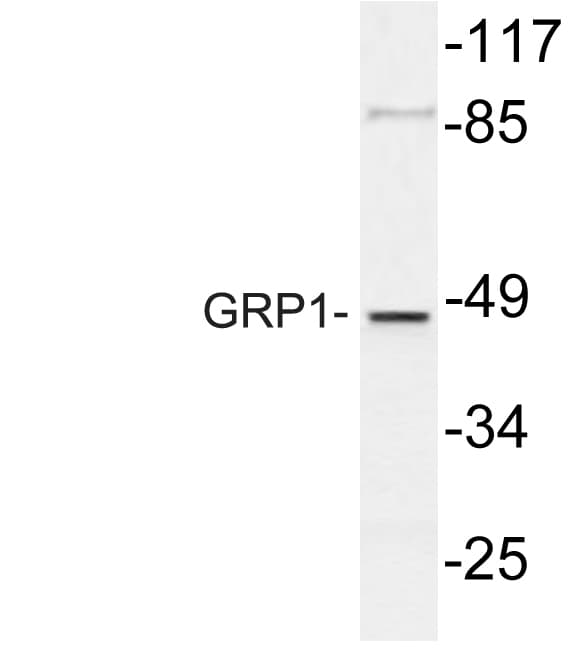 Polyclonal Rabbit anti-Human CYTH3 / GRP1 Antibody (Lys400, WB)