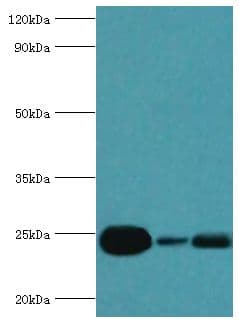 RAB5A / RAB5 Antibody (aa1-215)