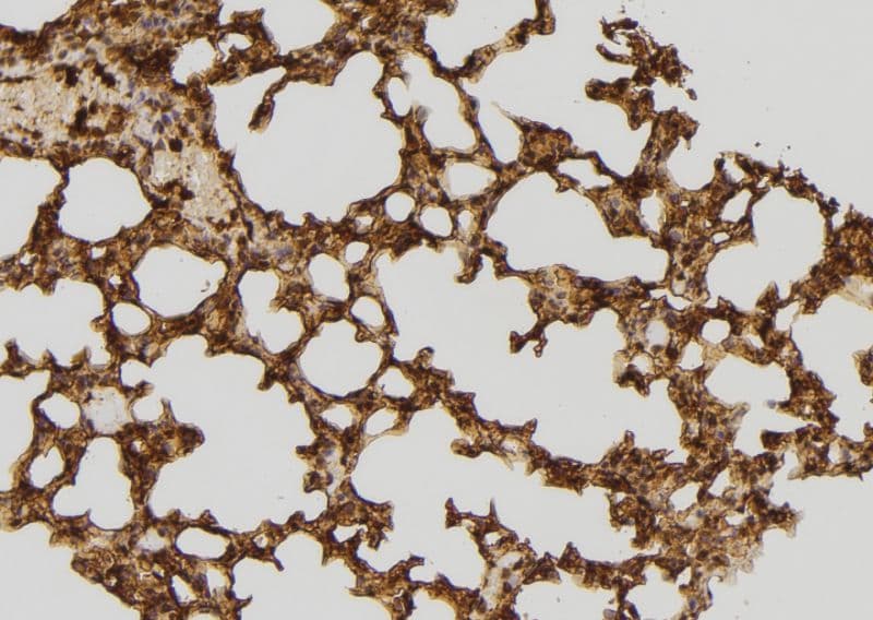 Polyclonal Rabbit anti-Human RFC4 Antibody (IHC, WB)