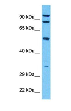 HSPA5 / GRP78 / BiP Antibody (C-Terminus)