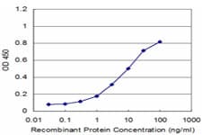 WASF2 / SCAR2 Antibody (clone 1F7)