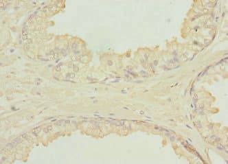 SH3GLB2 / Endophilin-B2 Antibody