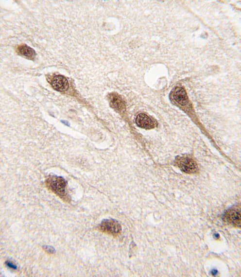 Polyclonal Rabbit anti-Human AML1 / RUNX1 Antibody (Ser276, IHC, IF, WB)