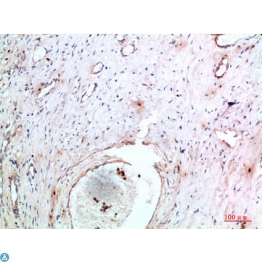 Polyclonal Rabbit anti-Human TNIP2 / ABIN-2 Antibody (IHC)