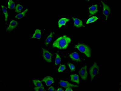 EVC2 Antibody