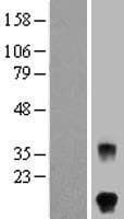 Human FSHB / FSH Beta Protein (Over-Expression Lysate Myc-DDK (Flag))