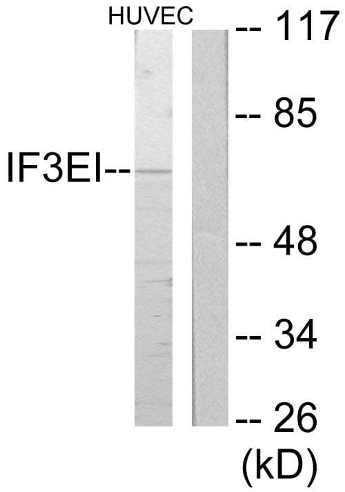 EIF3L / EIF3EIP Antibody