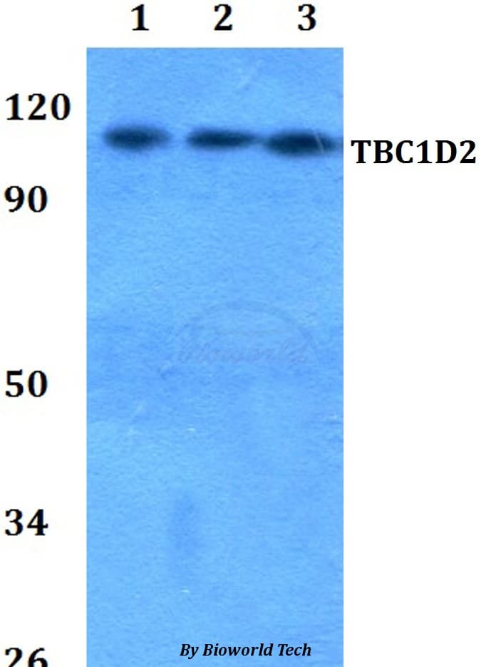 TBC1D2 Antibody
