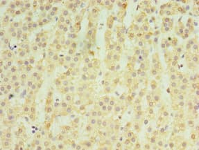 MATN3 / Matrilin 3 Antibody (aa277-486)