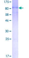 Human NFIA / Nuclear Factor 1 Protein (Recombinant GST)