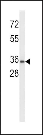 Polyclonal Rabbit anti-Human UPK1A / Uroplakin 1A Antibody (aa191-217, WB)