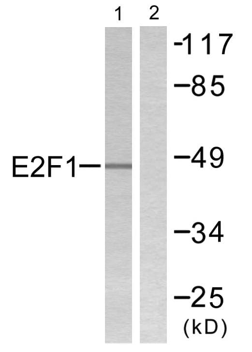 E2F1 Antibody (p433)