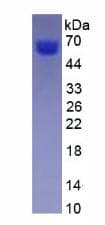 Rat AGT / Angiotensinogen Protein (Recombinant His, N-Terminal)