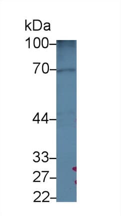 GOLM1 / GP73 / GOLPH2 Antibody (aa119-223)
