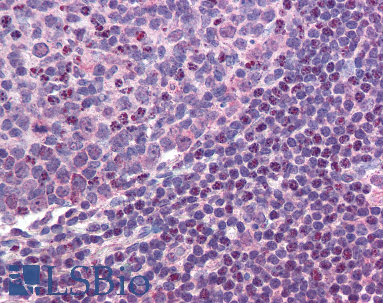 IHC-plus™ Polyclonal Rabbit anti-Human MALT1 Antibody (aa43-57, IHC, WB)