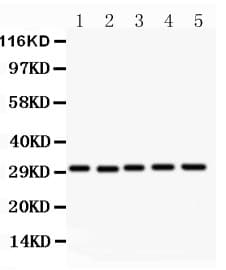 CD82 Antibody (aa98-267)