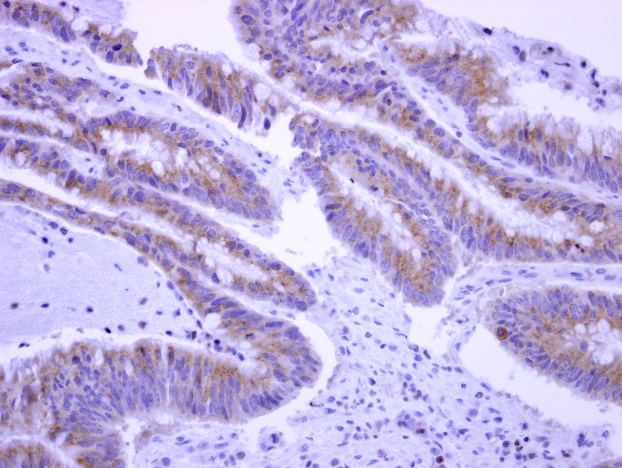 EPS8L2 Antibody