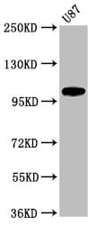 Polyclonal Rabbit anti-Human LGR6 Antibody (IHC, WB)