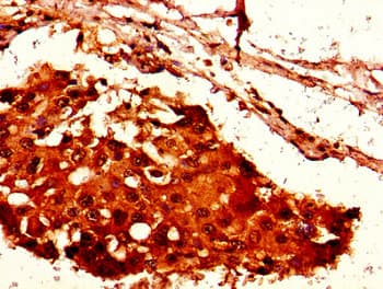 Polyclonal Rabbit anti-Human HIST1H2AI Antibody (IHC, IF)