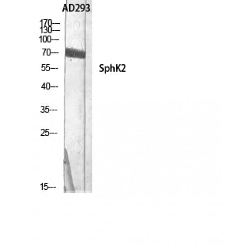 Polyclonal Rabbit anti-Human SPHK2 Antibody (550-630 aa, IHC, WB)