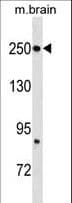 FASN / Fatty Acid Synthase Antibody (aa942-973)