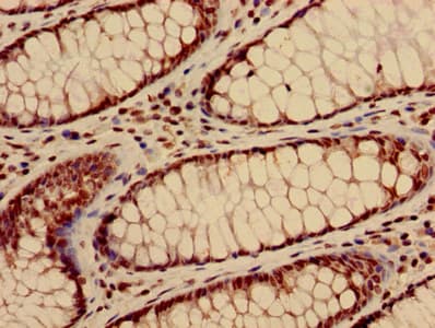 Polyclonal Rabbit anti-Human HIST1H3A Antibody (IHC, IF, WB)