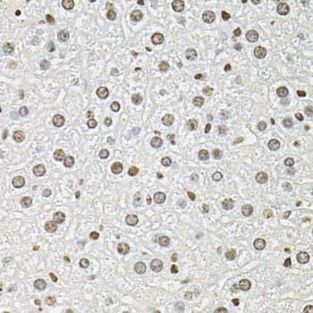 FRA-1 / FOSL1 Antibody