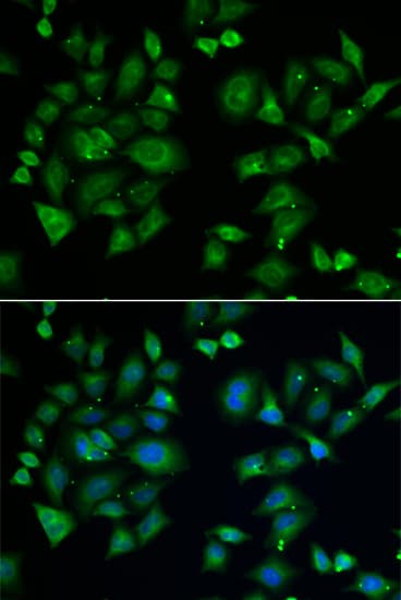 EPM2A / Laforin Antibody