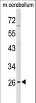PXMP4 Antibody (aa128-155)