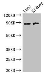 Polyclonal Rabbit anti-Human NAALADL2 Antibody (WB)