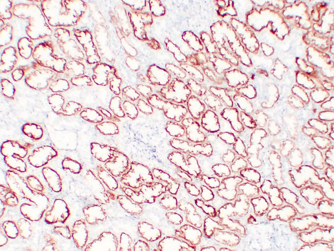 VHL / Von Hippel Lindau Antibody (clone ABT-PVHL)