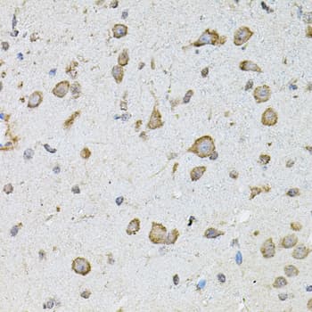 Polyclonal Rabbit anti-Human CHRFAM7A Antibody (IHC, WB)