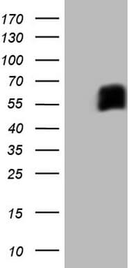 Monoclonal Mouse anti-Human CD33 Antibody (clone OTI7G8, WB)