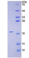 Human CGRP / Calcitonin Gene-Related Peptide Protein (Recombinant His)