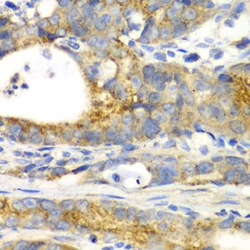 GORASP1 / GRASP65 Antibody