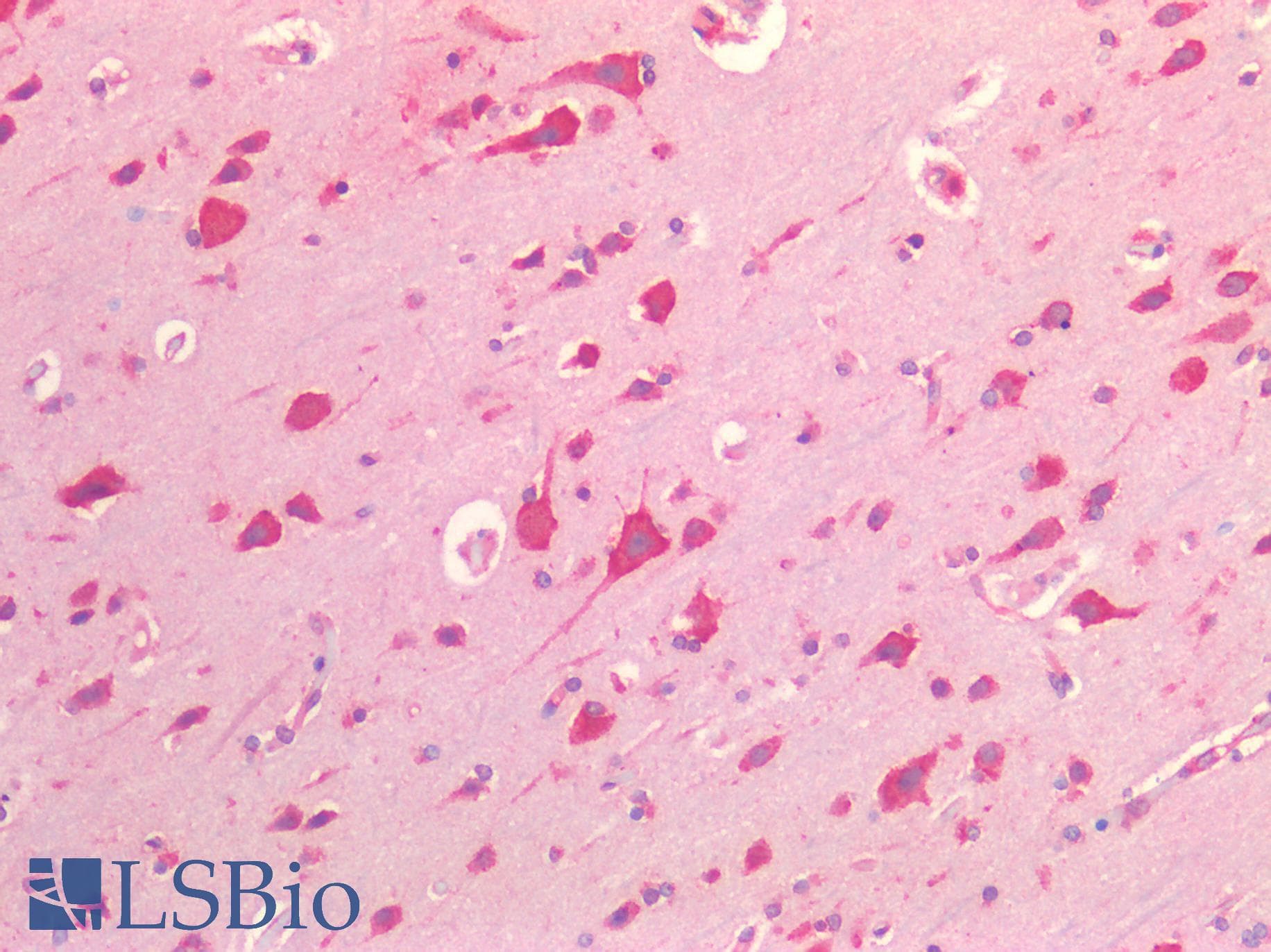 IHC-plus™ Polyclonal Rabbit anti-Human PDGFRA / PDGFR Alpha Antibody (IHC)