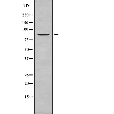 ACAP2 / Centaurin Beta 2 Antibody