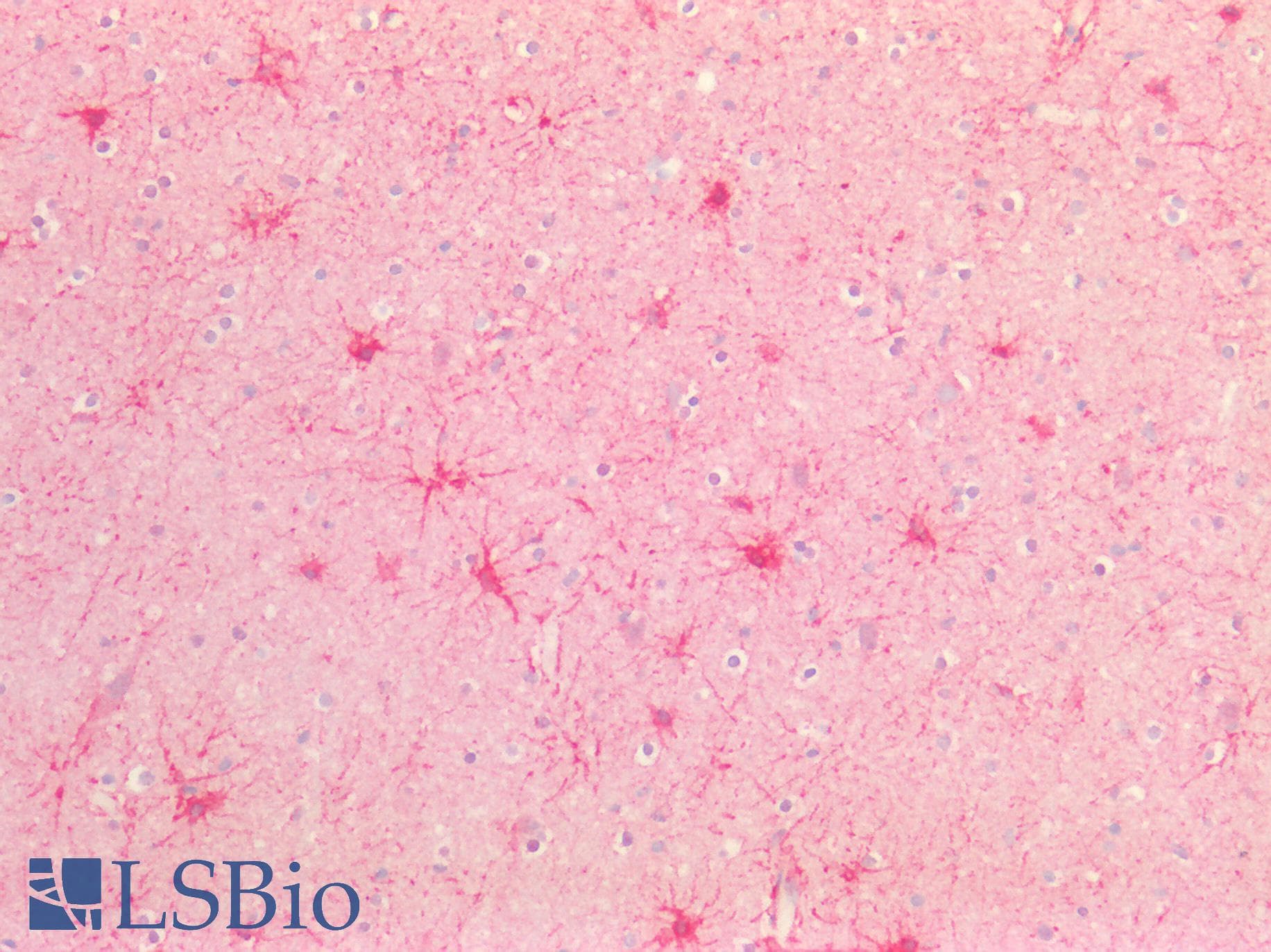IHC-plus™ Polyclonal Rabbit anti-Human ATXN2 / SCA2 / Ataxin-2 Antibody (aa721-780, IHC, WB)