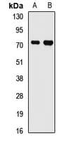 Polyclonal Rabbit anti-Human FMR1 / FMRP Antibody (WB)