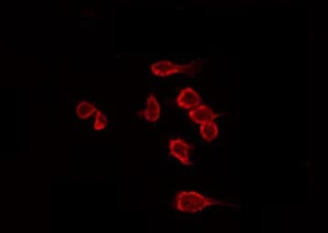 Dysferlin Antibody