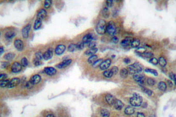 Polyclonal Rabbit anti-Human DNAJB1 / Hsp40 Antibody (Pro303, IHC, IF, WB)